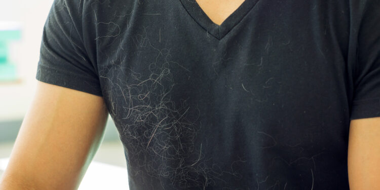 Easy tricks to remove pet hair from your clothes